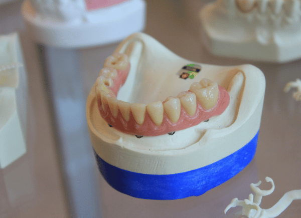 Complete dentures