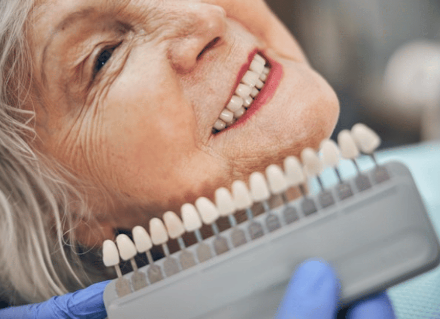 Getting color adjusted veneers