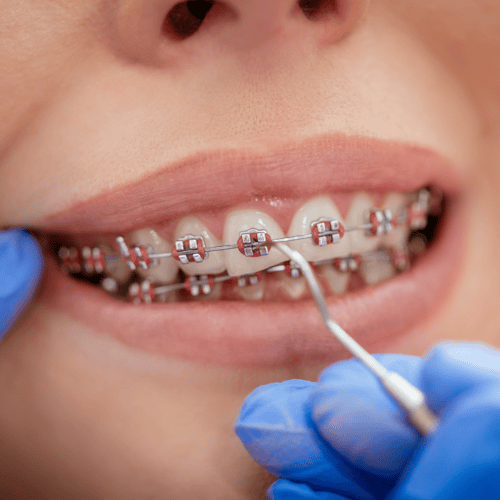 Everything You Should Know About An Orthodontist