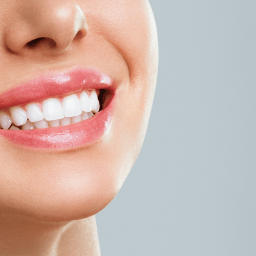 Teeth Whitening Secrets for a Radiant Smile in Rocky Hill