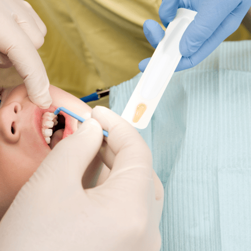 Diving Deep into Fluoride: Benefits, Myths, and Facts