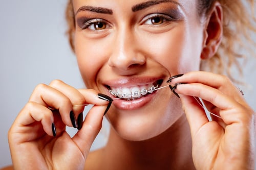 Maintaining Dental Health with Braces: The Importance of Flossing