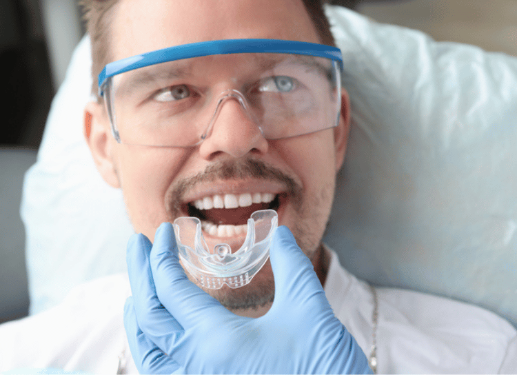 Mouth guard 1