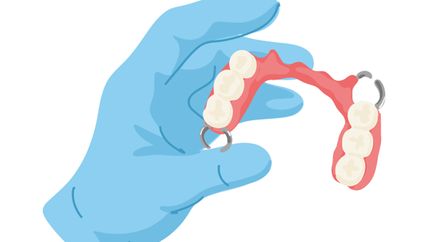 Partial Dentures