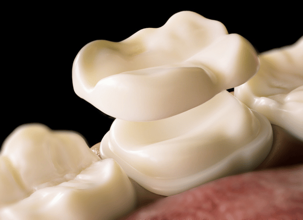 Porcelain crown