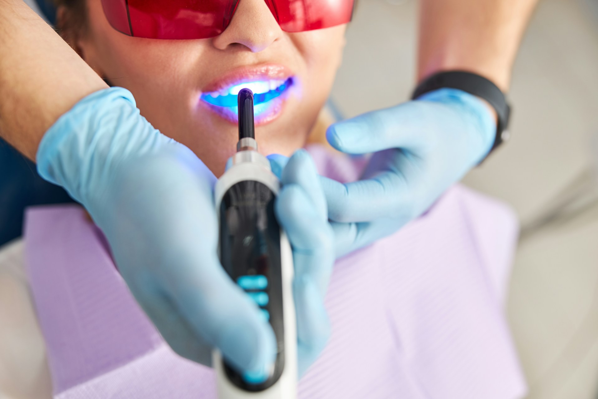 Professional Whitening