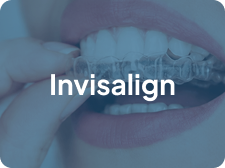 Invisalign