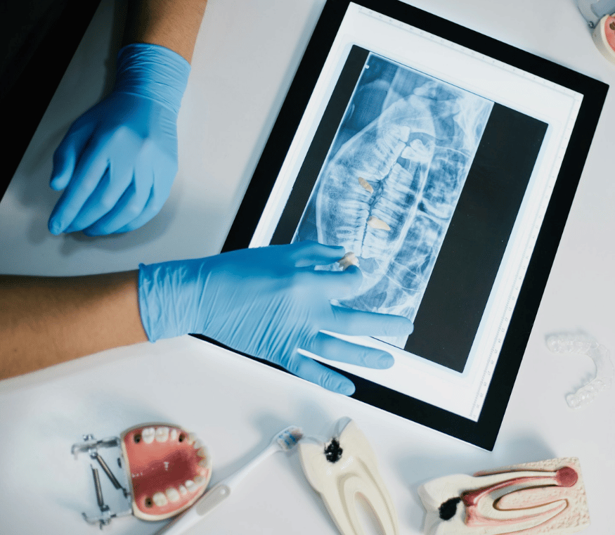 Tissue Regeneration procedure explanation