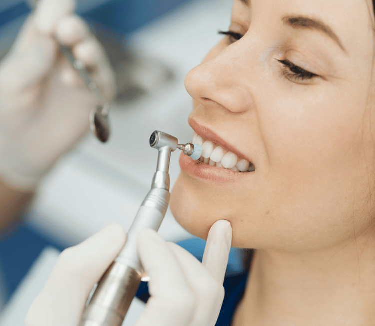 Veneers cleaning