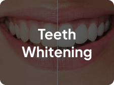 Teeth Whitening