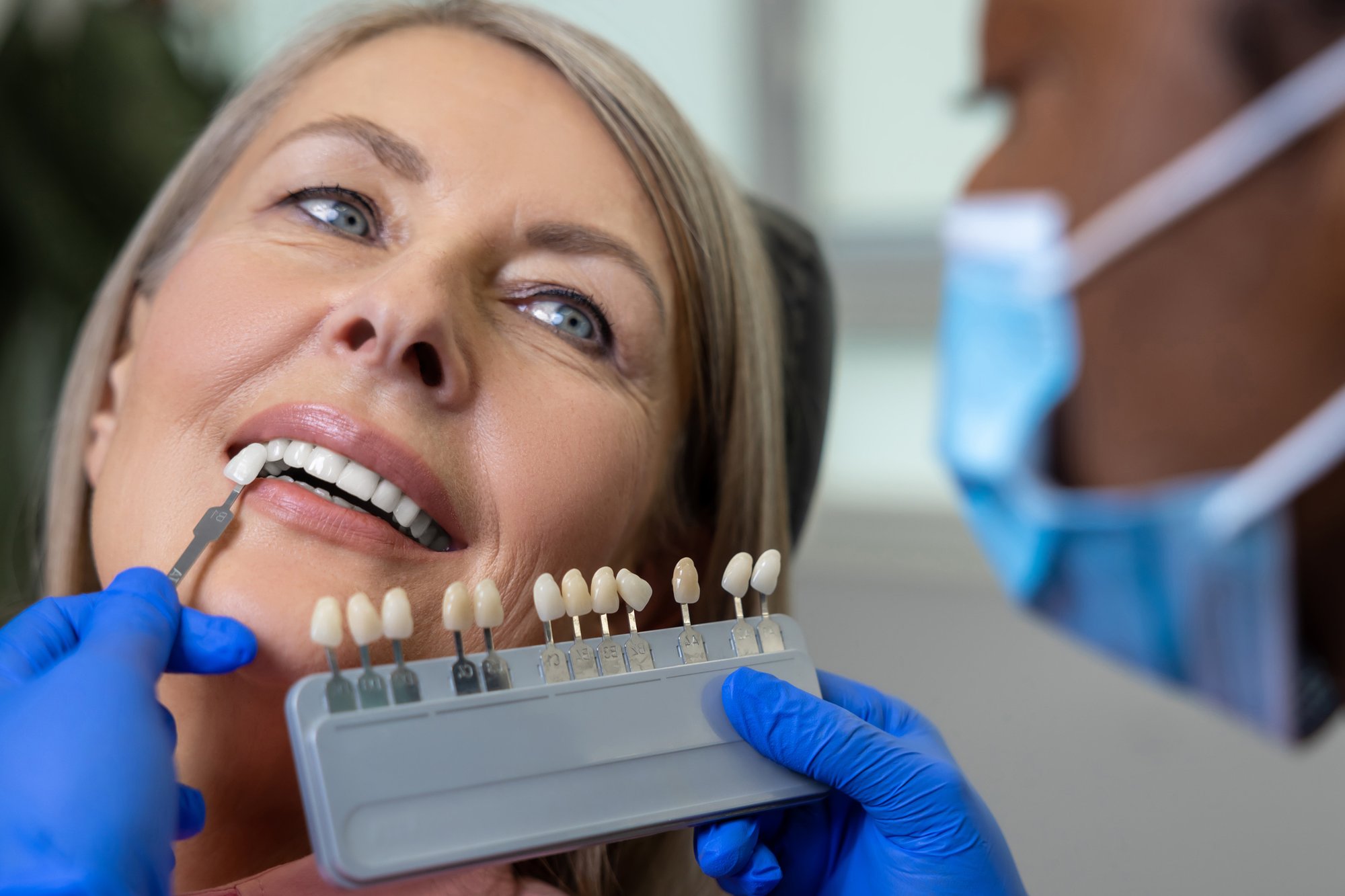 Dentist placing dental veneers to improve a patient’s smile