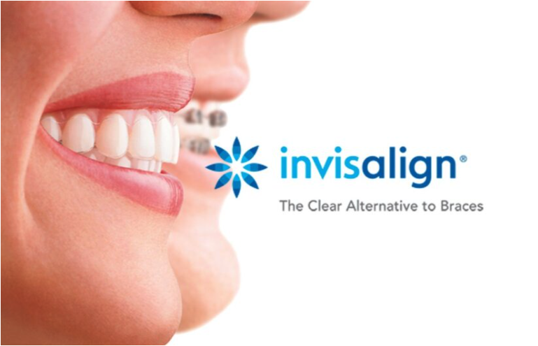 Read more about the article Invisalign
