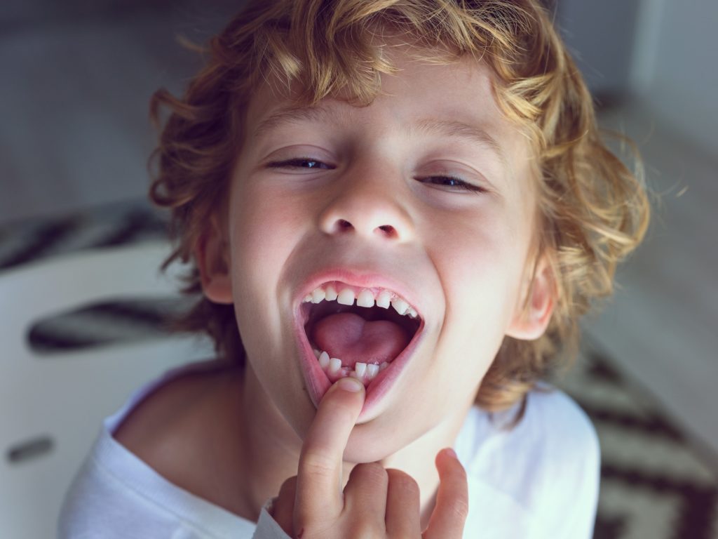 Cute little boy with lost tooth