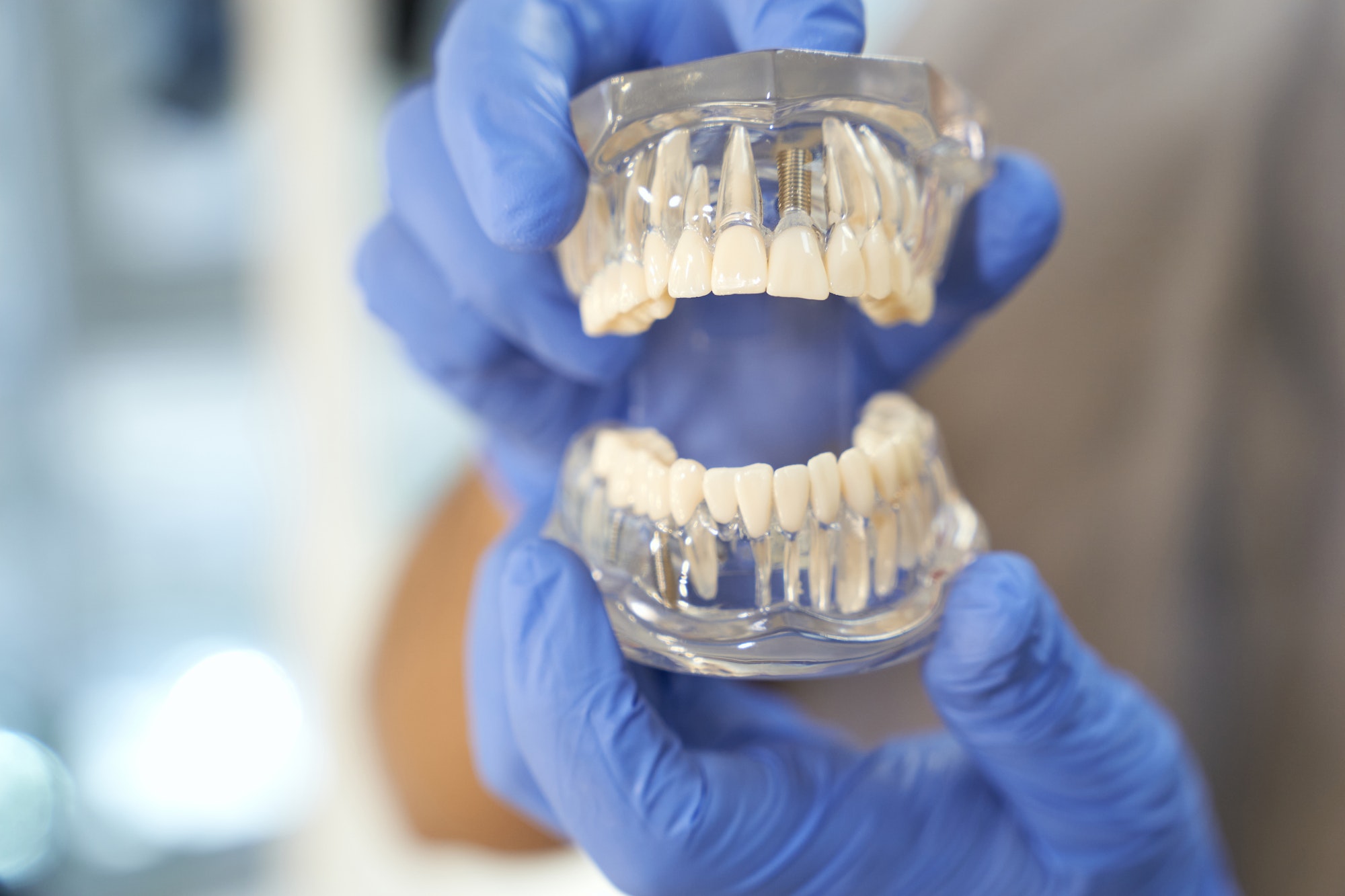 Dentist in gloves demonstrating model of human teeth