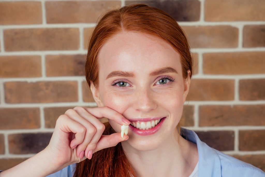 redhaired female with snow-white smile holding white wisdom tooth after extraction surgery